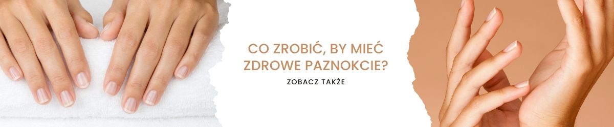 Co zrobić, by mieć zdrowe paznokcie - obrazek zobacz także