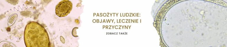 Pasożyty ludzkie objawy, leczenie i przyczyny. Blog Biozdrowy