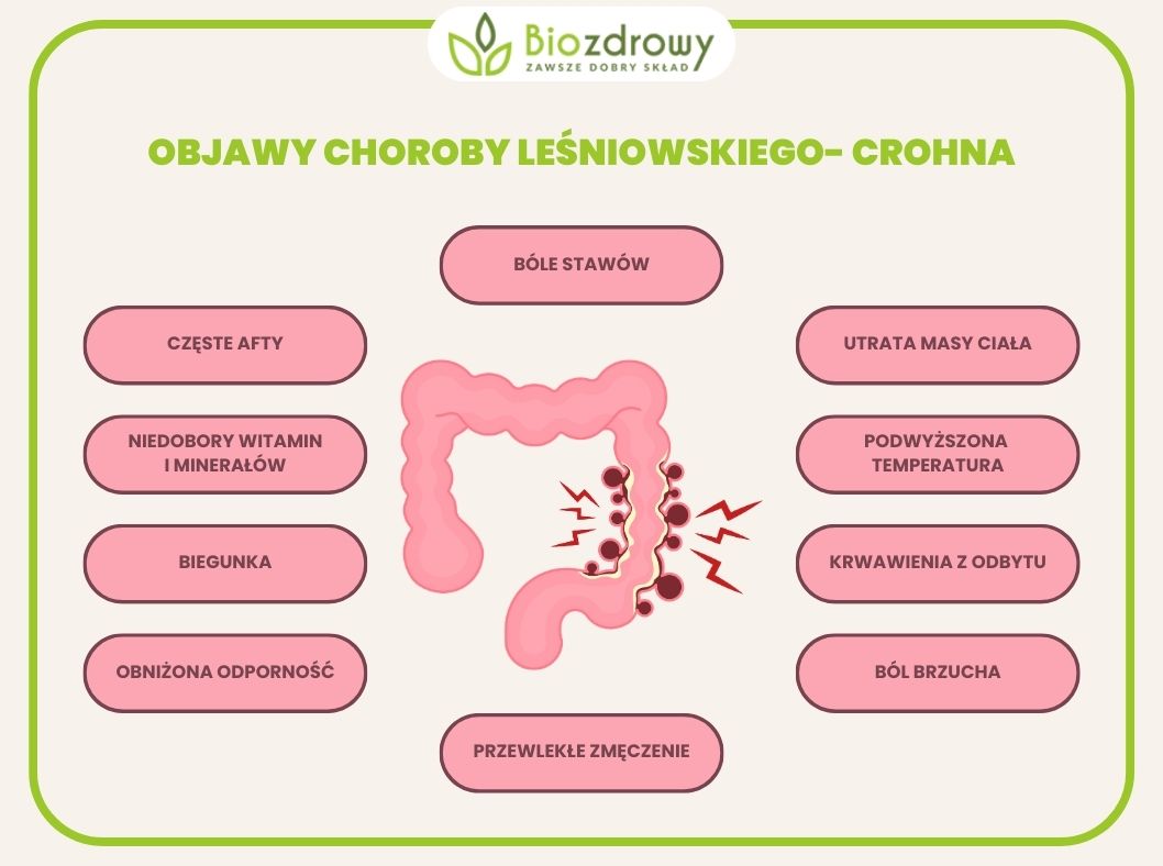 infografika - choroba Leśniowskiego- Crohna objawy