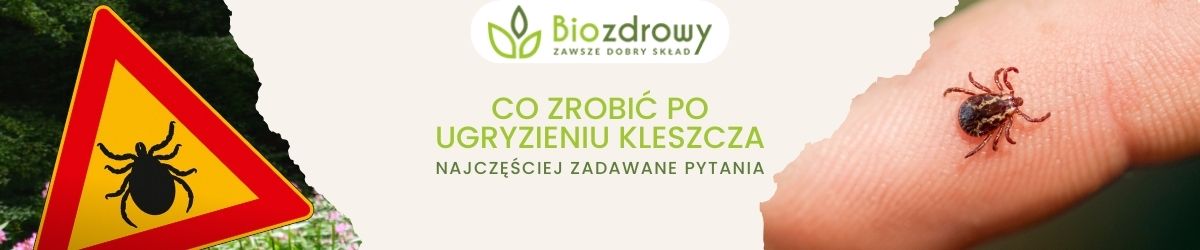 co zrobić po ugryzieniu kleszcza FAQ 