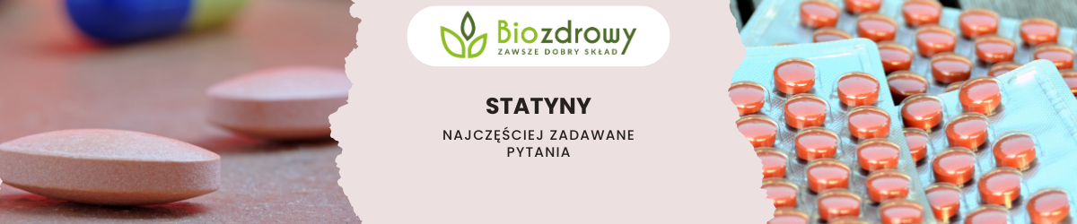 Statyny FAQ - zdjęcie poglądowe