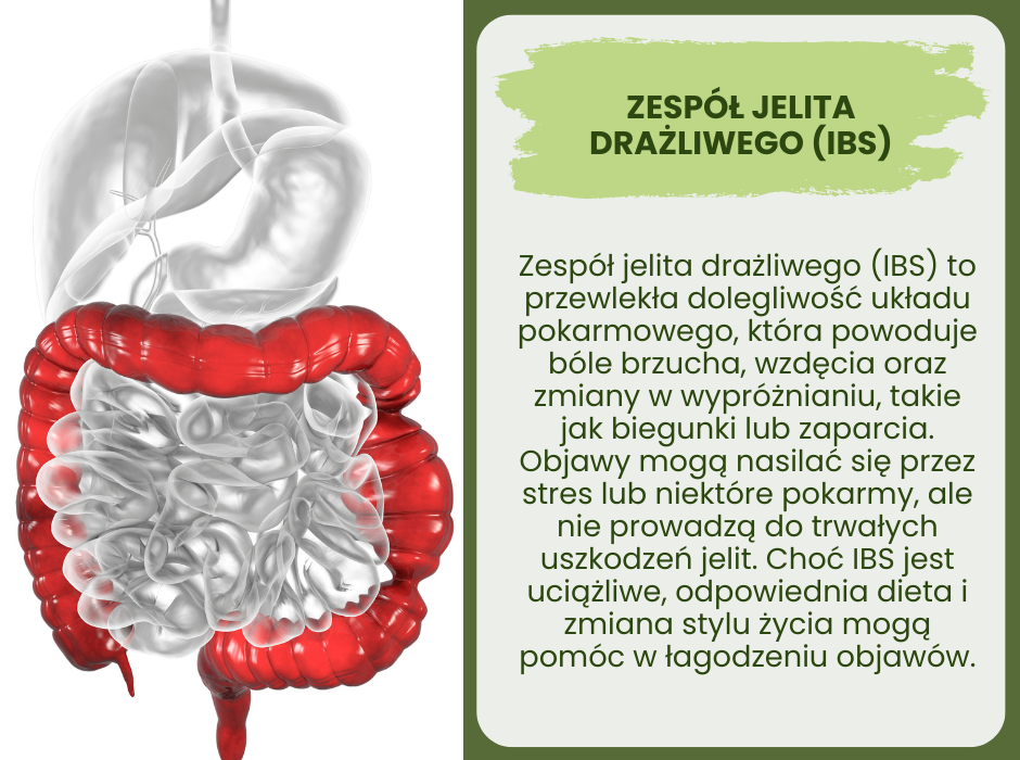 Zespół jelita drażliwego - infografika