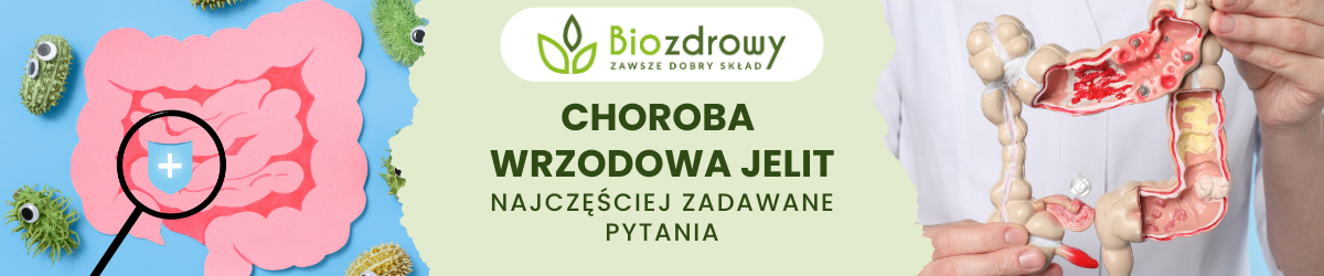 Choroba wrzodowa jelit FAQ - obrazek poglądowy