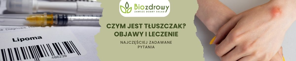 Czym jest tłuszczak Objawy i leczenie faq - najczęściej zadawane pytania