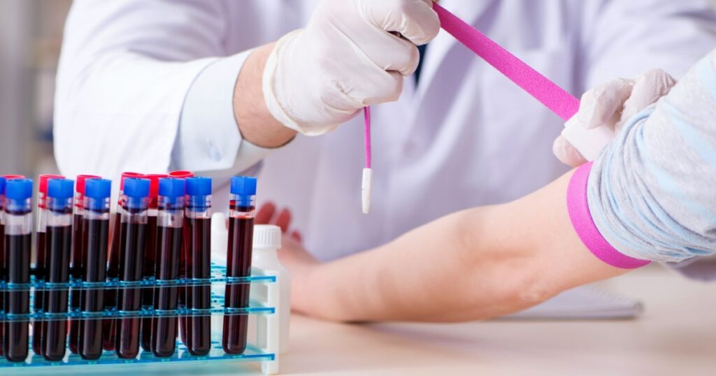 Badania krwi - czym sa i jakie są ich rodzaje - obrazek wyróżniający