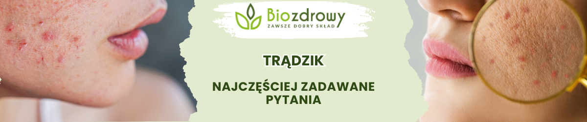 Trądzik FAQ - obrazek poglądowy