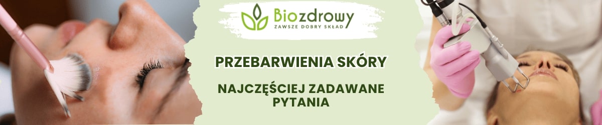 przebarwienia skóry faq - obrazek poglądowy
