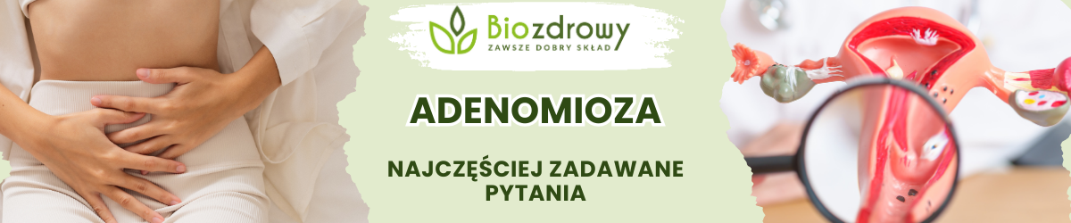 Adenomioza FAQ - obrazek poglądowy