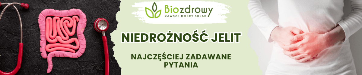 Niedrożność jelit FAQ - obrazek poglądowy