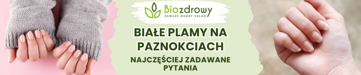 Białe plamy na paznokciach FAQ - obrazek poglądowy