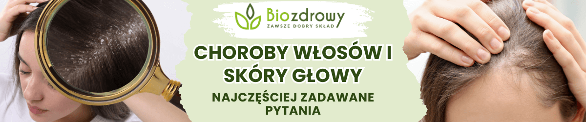 Choroby włosów i skóry głowy FAQ - obrazek poglądowy