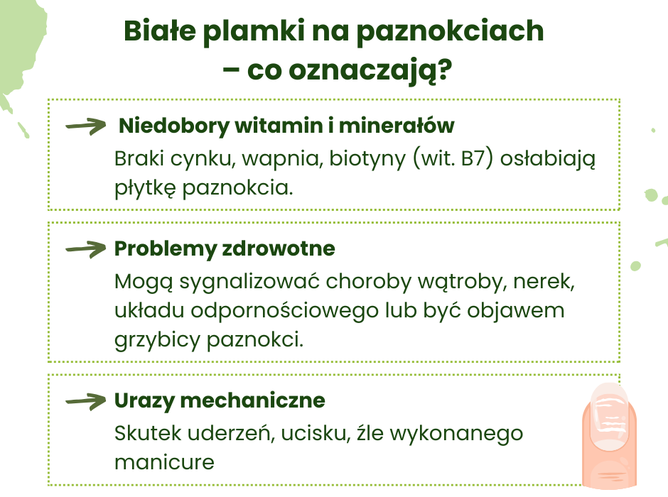 Co oznaczają białe plamki na paznokciach? - infografika