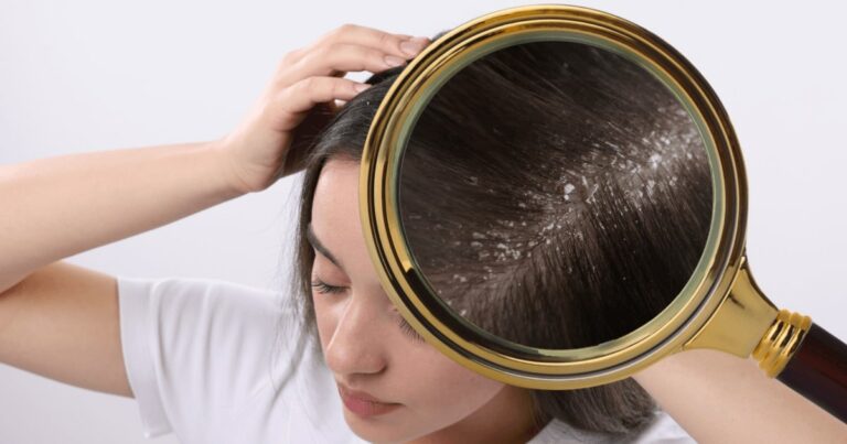 Najczęstsze choroby włosów i skóry głowy – jak je rozpoznać i leczyć - obrazek wyróżnijący