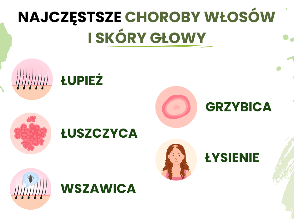 Najczęstsze choroby włosów i skóry głowy - infografika