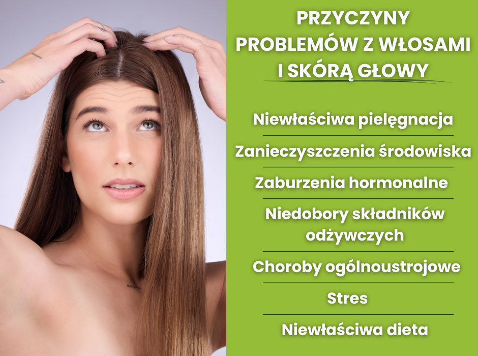 Problemy z włosami i skórą głowy - przyczyny - infografika