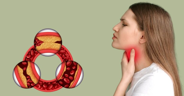 Tarczyca i cholesterol - jak działają na siebie nawzajem - obrazek wyróżniający