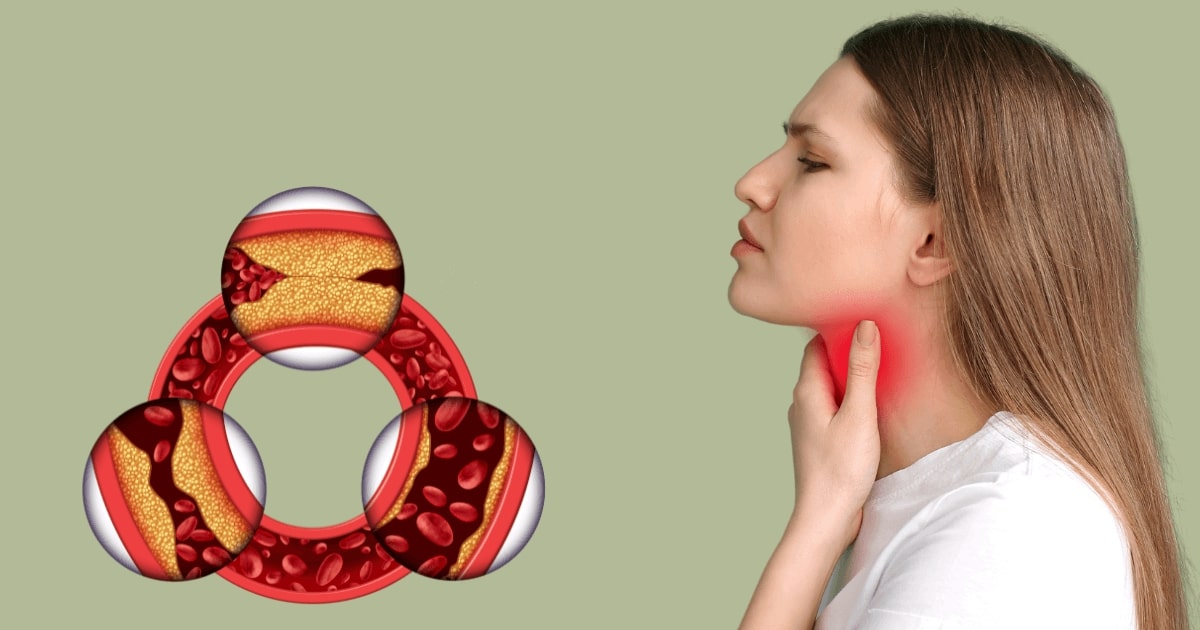 Tarczyca i cholesterol - jak działają na siebie nawzajem - obrazek wyróżniający