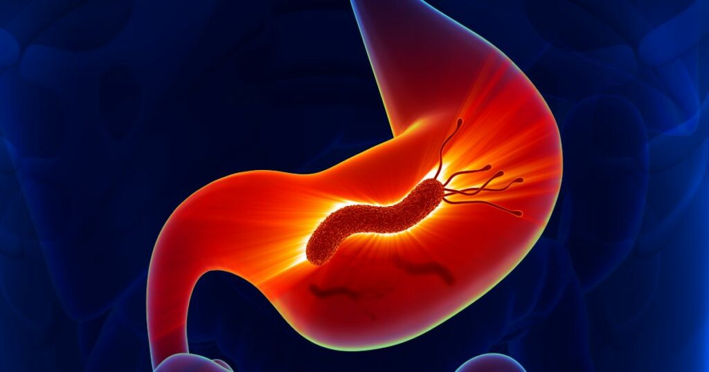 Dieta przy Helicobacter pylori–co warto wiedzieć - obrazek wyróżniający
