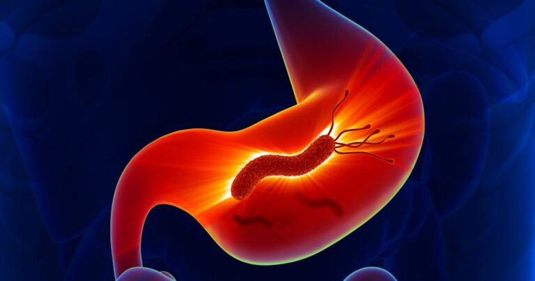 Dieta przy Helicobacter pylori–co warto wiedzieć - obrazek wyróżniający