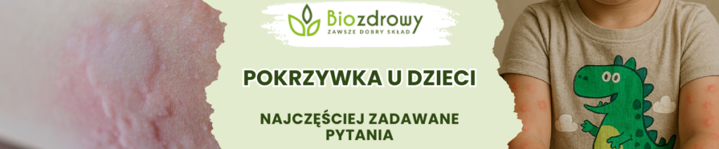 Pokrzywka u dzieci FAQ - obrazek poglądowy