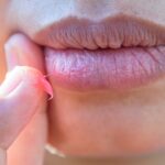 Suche usta–jak je skutecznie nawilżyć i zregenerować - obrazek wyróżniający