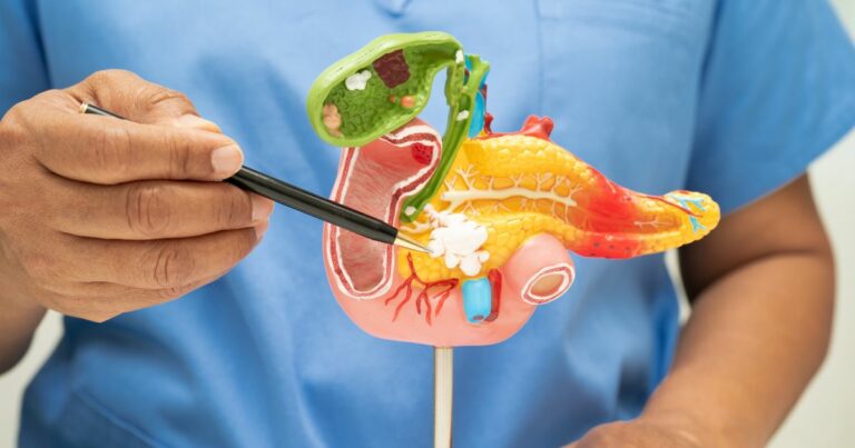 Dieta trzustkowa – jak jeść, by odciążyć trzustkę i złagodzić objawy? - obrazek wyróżniający