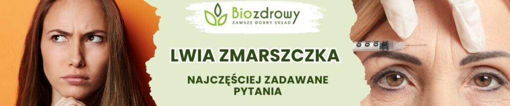 Lwia zmarszczka FAQ - obrazek poglądowy
