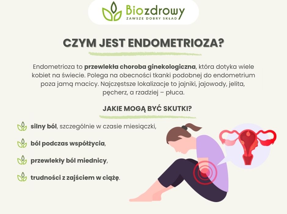 Czym jest endometrioza - infografika