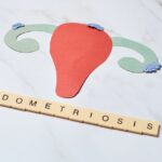 Endometrioza–co ją powoduje, jak się objawia i jak wspomóc leczenie - obrazek wyróżniający