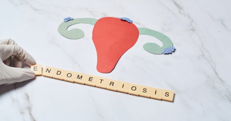 Endometrioza–co ją powoduje, jak się objawia i jak wspomóc leczenie - obrazek wyróżniający
