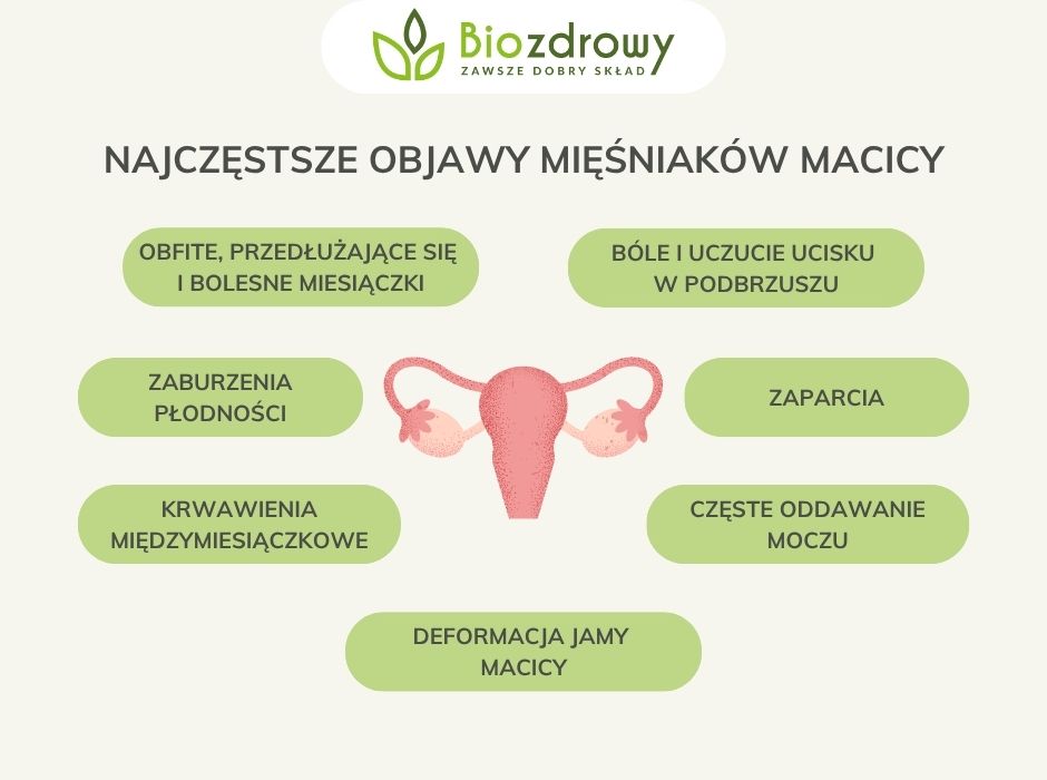 Najczęstsze objawy mięśniaków macicy - infografika