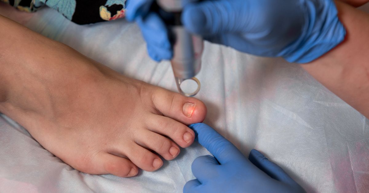 Jak rozpoznać i leczyć grzybicę paznokci oraz stóp? - obrazek wyróżniający