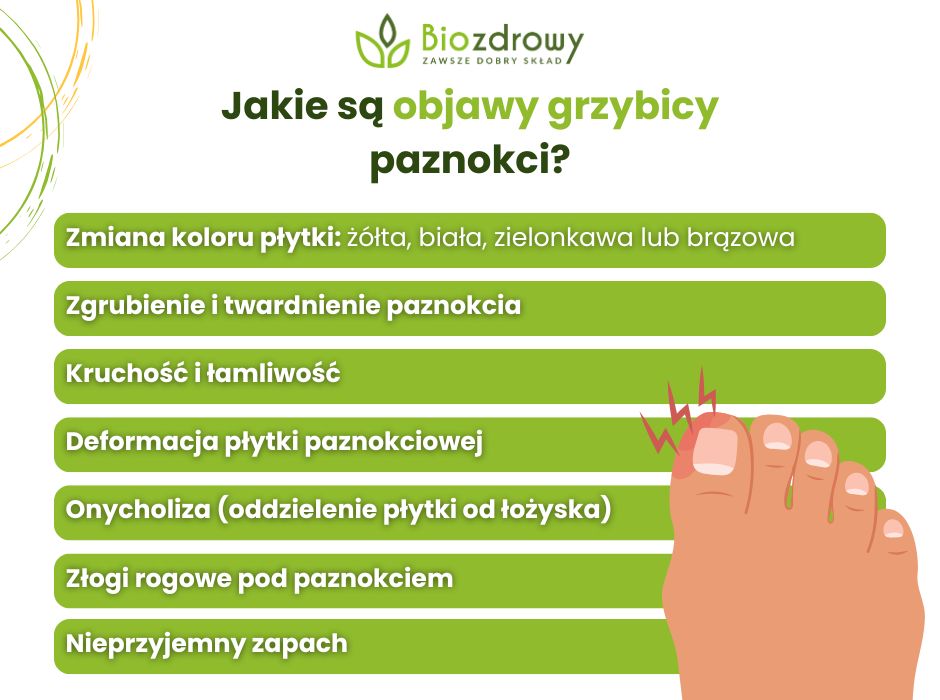Objawy grzybicy paznokci - infografika