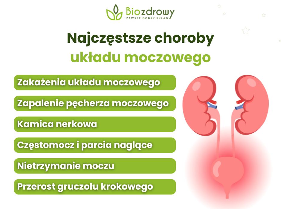 Najczęstsze choroby układu moczowego - infografika