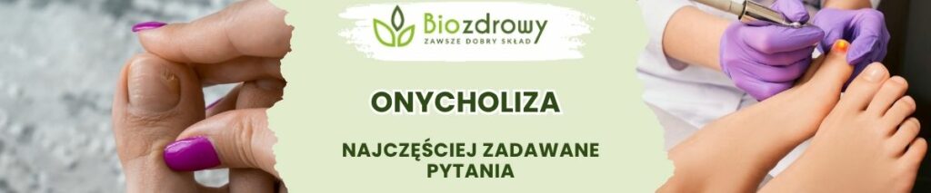 Onycholiza FAQ - obrazek poglądowy
