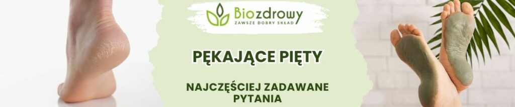 Pękające pięty FAQ - obrazek poglądowy