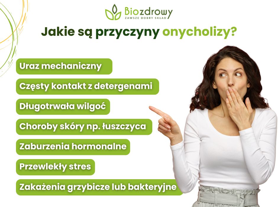 Przyczyny onycholizy - infografika