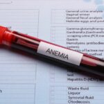 Anemia-jak ją rozpoznać Przyczyny, objawy i leczenie niedokrwistości - obrazek wyróżniający