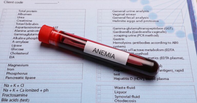 Anemia-jak ją rozpoznać Przyczyny, objawy i leczenie niedokrwistości - obrazek wyróżniający