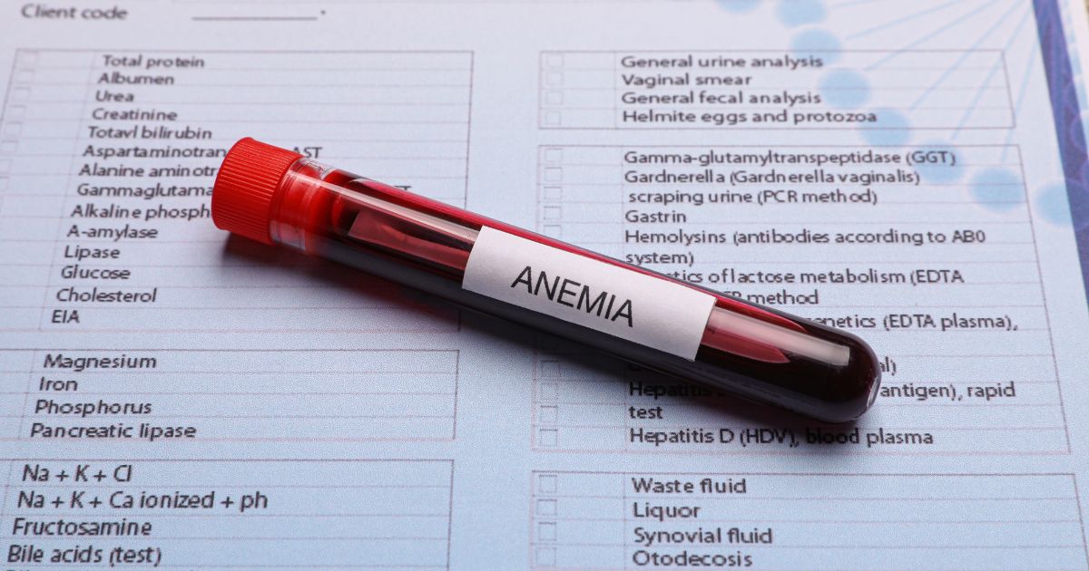 Anemia-jak ją rozpoznać Przyczyny, objawy i leczenie niedokrwistości - obrazek wyróżniający