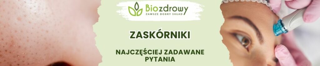 Zaskórniki FAQ - obrazek poglądowy