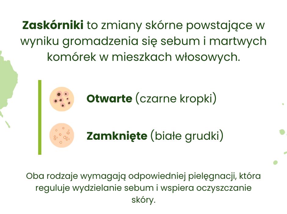 Zaskórniki - infografika