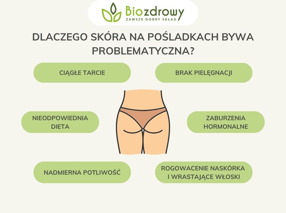 Dlaczego skóra na pośladkach bywa problematyczna - infografika