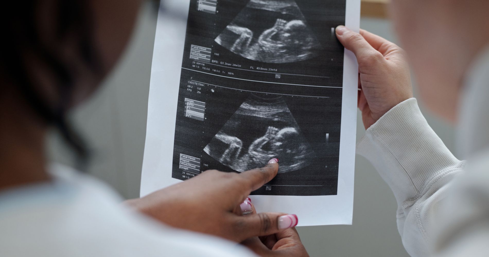 Lekarz i pacjentka oglądają zdjęcie USG płodu – symbol nadziei na ciążę i znaczenia zdrowia organizmu.