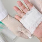 Jak wygląda prawidłowa pielęgnacja rany Poradnik krok po kroku - obrazek wyróżniający