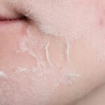 Sucha skóra–skąd się bierze i jak sobie z nią radzić - obrazek wyróżniający