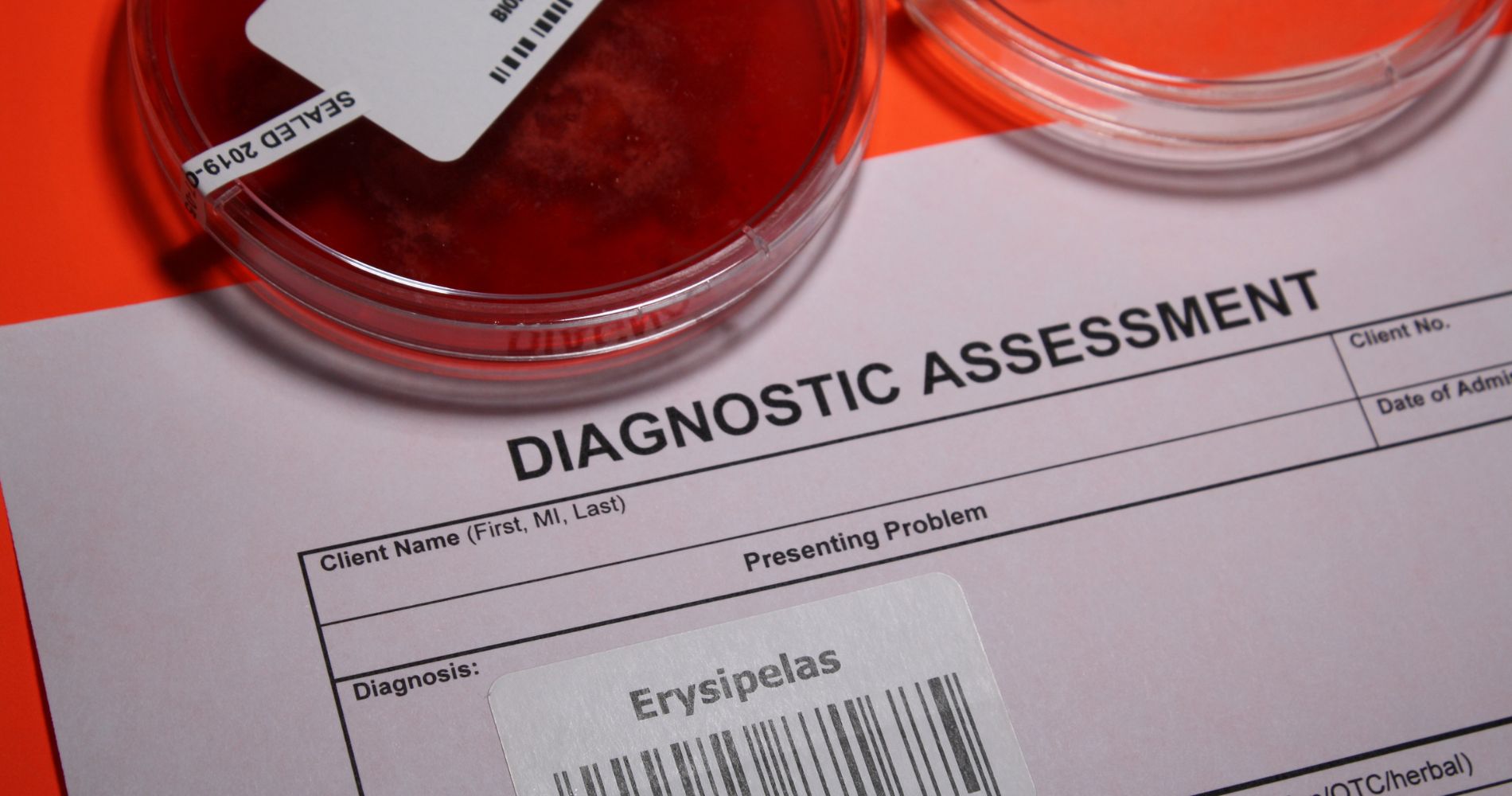 Dokument diagnostyczny z rozpoznaniem róży (erysipelas) obok próbki laboratoryjnej.