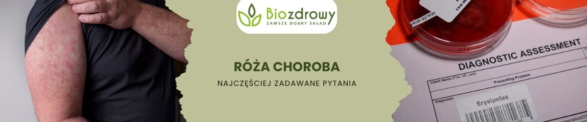 róża choroba faq - najczęściej zadawane pytania
