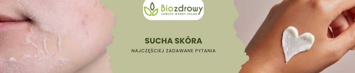 sucha skóra faq - najczęściej zadawane pytania