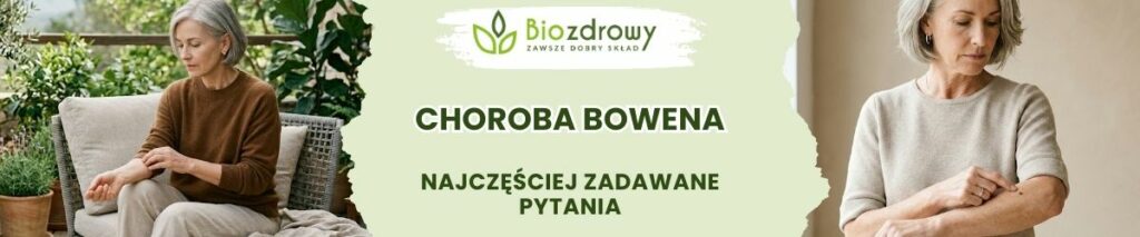 Choroba Bowena FAQ - obrazek poglądowy